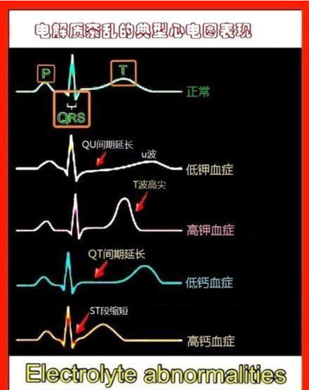 電解質(zhì)紊亂