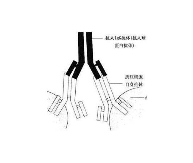 直接抗人球蛋白試驗(yàn)