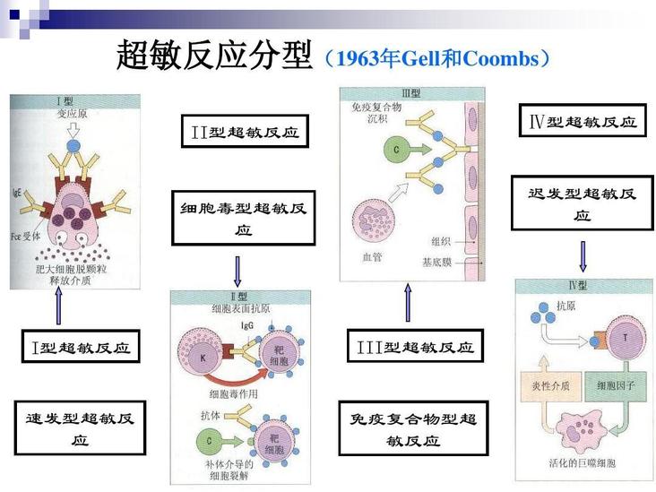 Ⅲ型超敏反應(yīng)