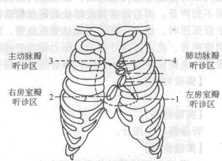 第一心音