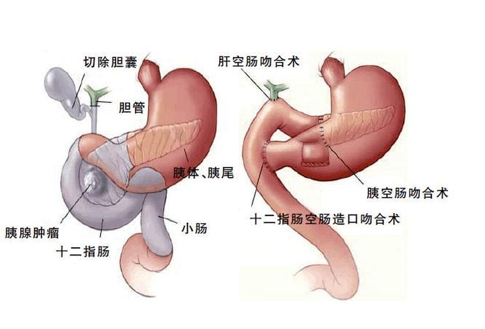 十二指腸