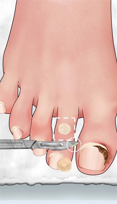 沉浸式修腳大師1